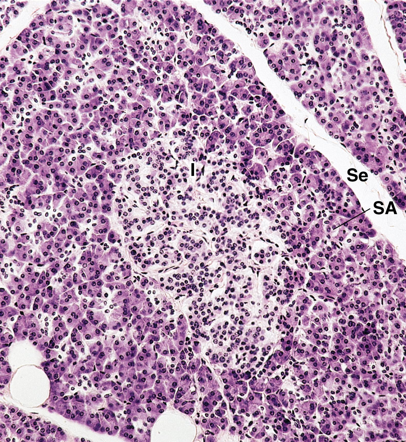 Fig. 18.15, Photomicrograph of the human pancreas displaying secretory acini and an islet of Langerhans (I). The histological difference between the exocrine and endocrine pancreas is very evident in this photomicrograph because the islet is much larger than individual acini and is much lighter in color. Se, Septum; SA, serous acinus. (×132)