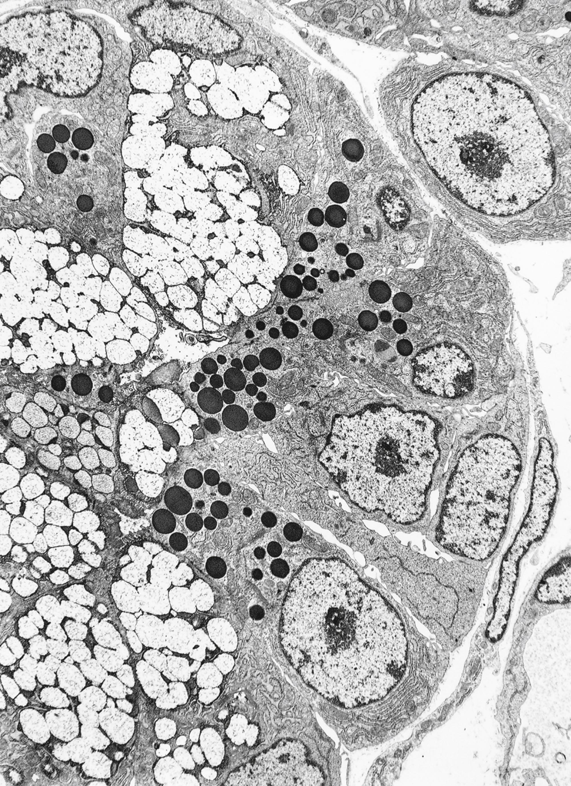 Fig. 18.3, Electron micrograph of the rat sublingual gland, displaying serous and mucous granules in the cytoplasm of their acinar cells. Note that the nuclei of serous cells are round, whereas the nuclei of mucous cells are flattened. Observe also that the serous secretory products are present as round, dense, dark structures, and the mucous secretory products are mostly dissolved and appear light in color and spongy (×5400).