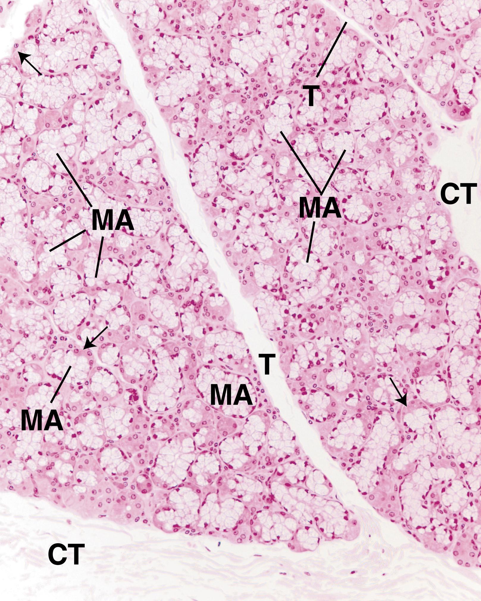 Fig. 18.6, This low-magnification photomicrograph of the sublingual gland displays connective tissue (CT) organized into septae (T) of various thicknesses that subdivide the gland into lobes and lobules. Observe the preponderance of mucous acini (MA) with their serous demilunes (arrows) . (×132).