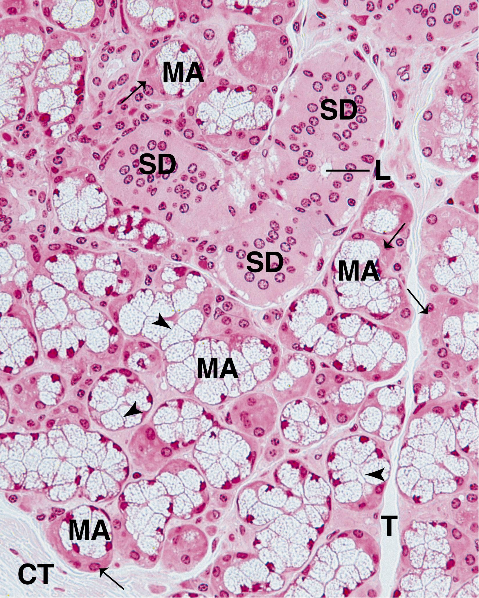 Fig. 18.7, This medium-magnification photomicrograph of a sublingual gland displays sections of one of the more striated ducts (SD) with a central lumen (L). Observe that the nuclei are more or less centrally placed within the cells composing the duct. The mucous acini (MA) are composed of several cells whose cell membranes are indicated by arrowheads and are filled with secretory vesicles whose contents have been extracted during the slide preparation. Note that the nuclei of the mucinogen-producing cells are basally located and present a flattened morphology. The serous demilunes (arrows) are composed of serous cells with round, centrally located nuclei. Connective tissue septa (T) subdivide the gland into lobes and lobules. (×270)