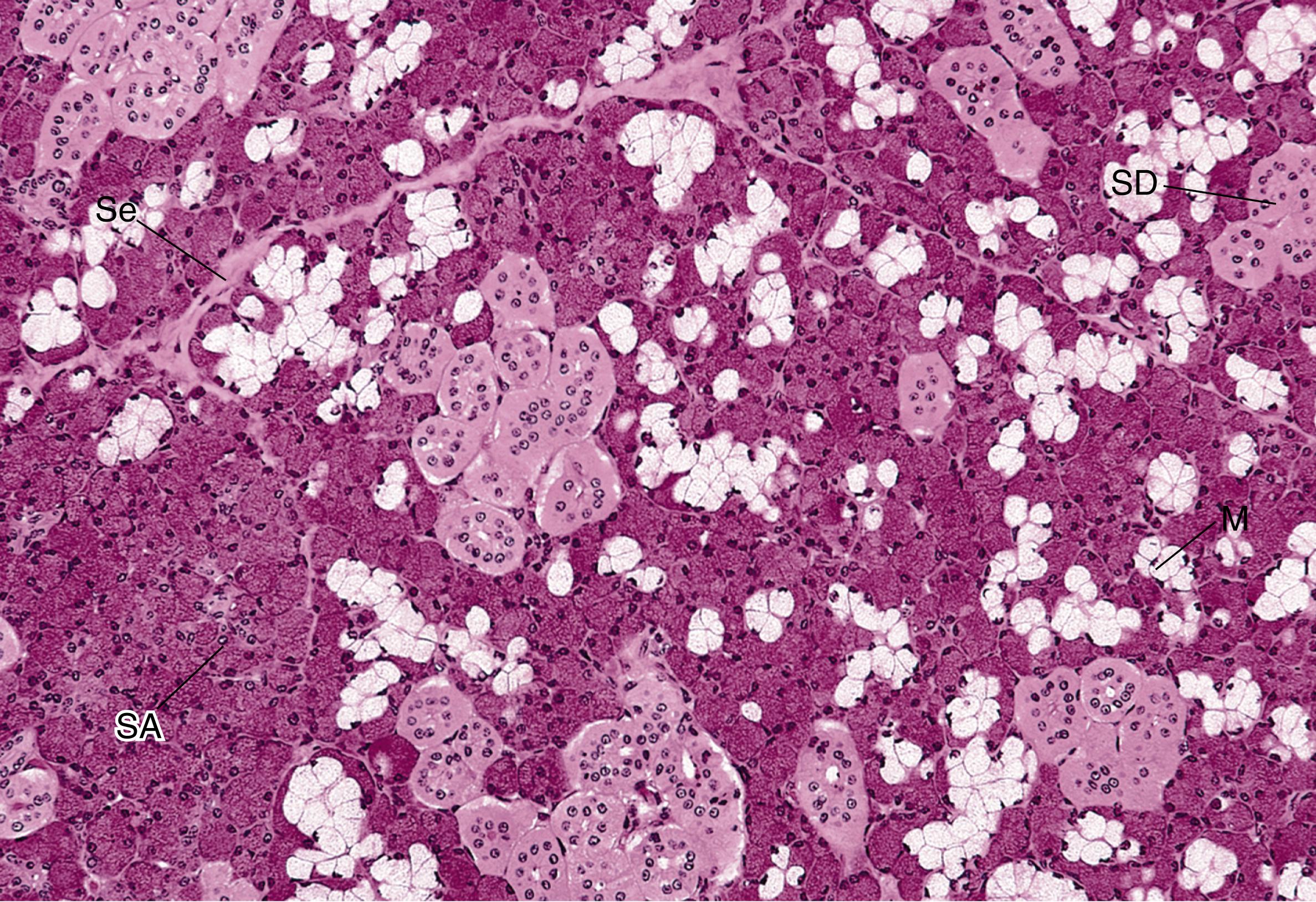 Fig. 18.8, The submandibular gland is characterized by the numerous cross-sectional profiles of striated ducts. Note that the ducts appear pale pink, and many display a very small but clear lumen. The mucous secretory product has a frothy-looking appearance. Se, Septum; SA, serous acinus; SD, serous demilune; M, mucous cell of the acinus. (×132)