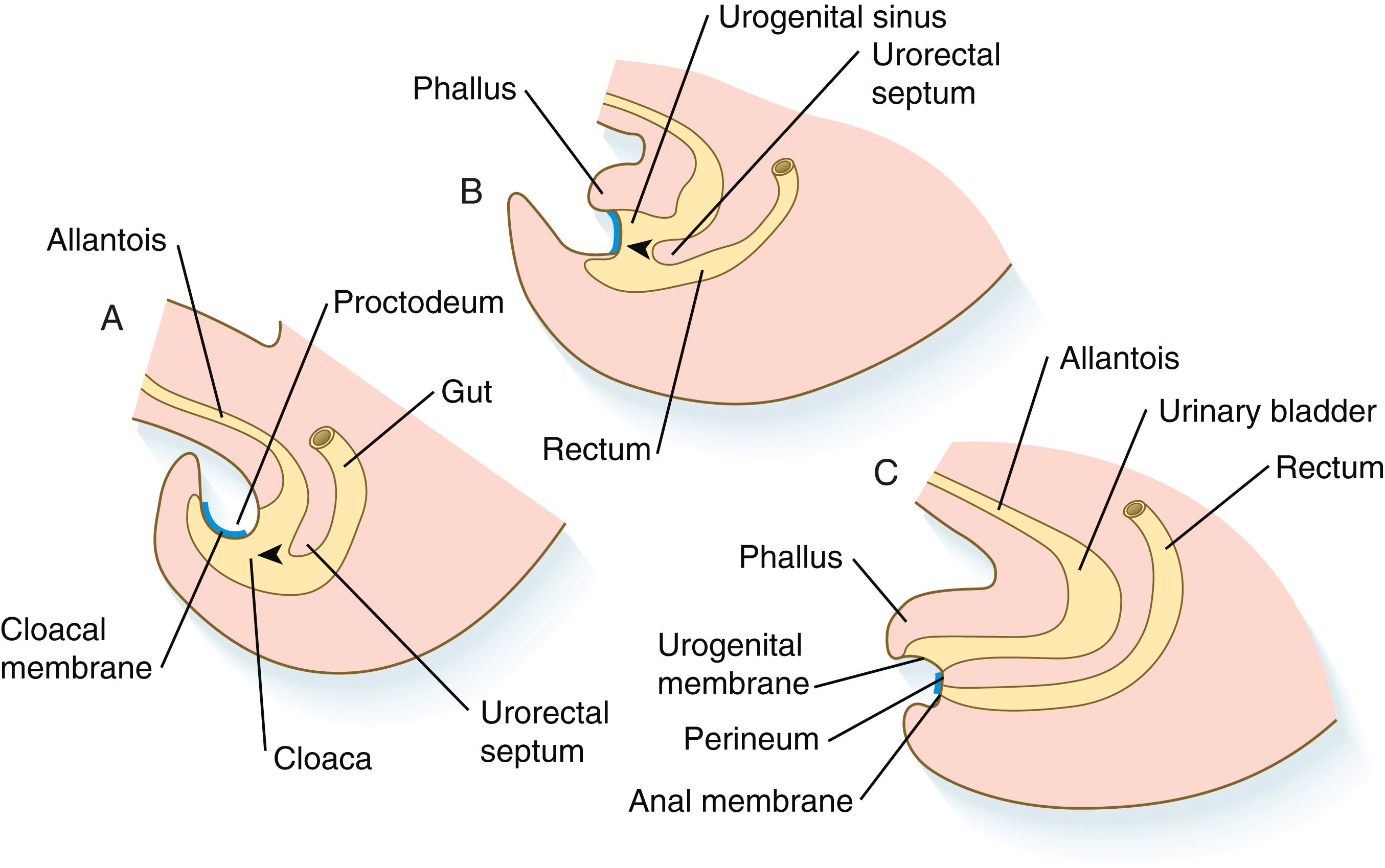 Fig. 15.13, Stages in the subdivision of the common cloaca by the urorectal septum.