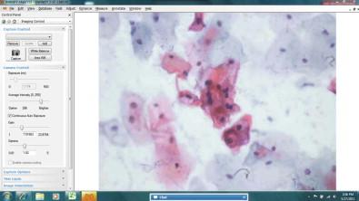 Figure 34-5, The use of real-time computer screen sharing devices allows a relatively simple telecytology application to be realized. In this example, cervical cytology slides are being visualized on a microscope with a digital camera, laptop computer, and internet connection in Cusco, Peru, and being reviewed by multiple pathologists in the USA simultaneously. Verbal communication via telephone allows for control of the microscope coordinates, focus, and magnification.