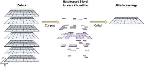 Figure 34-6, In this schematic, a z-stack of images captured and reviewed as a “single” image is shown on the left. In the middle frame, a process referred to as “extended focus” scans the slide in multiple planes, but, via a software manipulation, uses the best focused tile at each location on the slide to make a final composite image, which shows a better, but not fully, focused image. This method cannot defeat a true 3-dimensional grouping of cells, but can better resolve single cells when they are at differing levels on the slide.