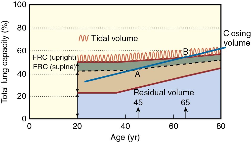 Fig. 30.6, Changes in lung volumes and capacities with aging. Residual volume and functional residual capacity (FRC) increase with age, whereas total lung capacity remains the same. Closing volume increases with age and exceeds FRC in the supine position at about age 45 and exceeds FRC in the upright position at about age 65.
