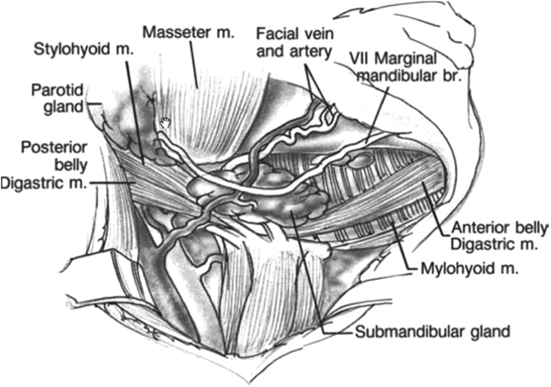 Fig. 15.3, Anatomy of the submandibular triangle.