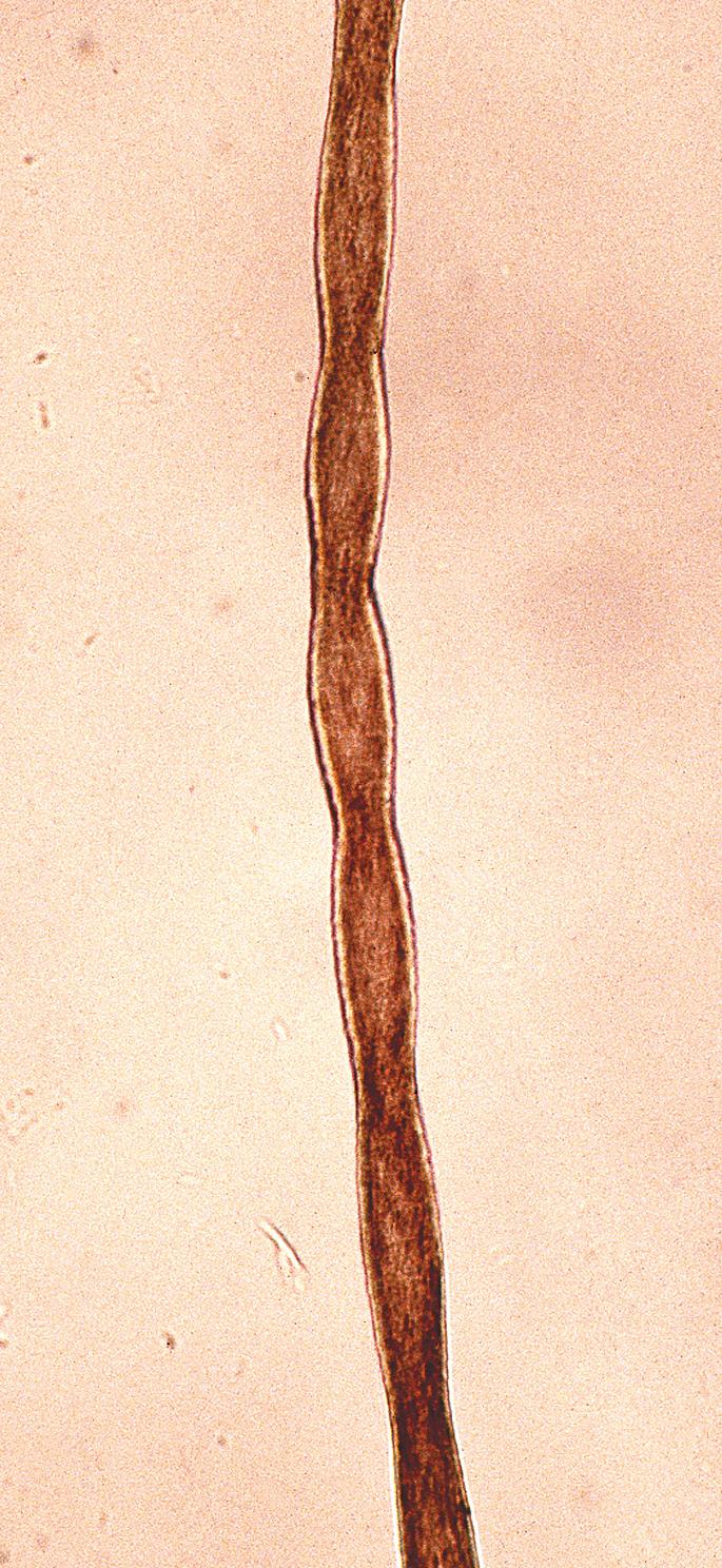 Fig. 33.22, Pili torti.