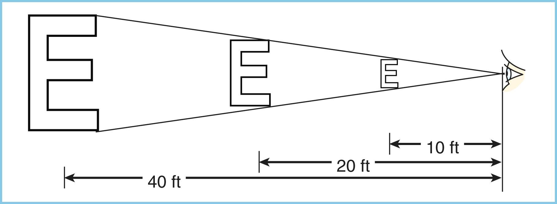 E-FIGURE 391-1, Snellen visual acuity. The most common test for visual acuity measures the eye’s ability to resolve linear images at a test distance of 20 feet, approximating infinity (parallel rays of light). A 20/20 E subtends 5 minutes of arc at a distance of 20 feet, with each segment of the E subtending 1 minute of arc. The larger letters (e.g., 20/30, 20/40) are determined by the distance at which they subtend an angle of 5 minutes. Thus, an E that subtends 5 minutes at 40 feet, if viewed clearly at 20 feet, indicates 20/40 visual acuity.