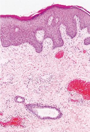 Fig. 12.9, Perianal skin. Keratinized squamous epithelium and an underlying apocrine gland. H&E.