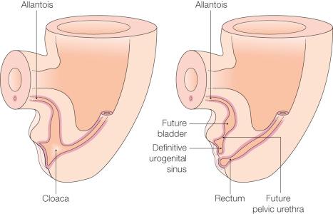 Fig. 12.10, Development of the primitive urogenital sinus. Between 4 and 6 weeks, the urorectal septum splits the cloaca into an anterior primitive urogenital sinus and a posterior rectum. The superior part of the primitive urogenital sinus, continuous with the allantois, forms the bladder. The constricted pelvic urethra at the base of the future bladder forms the membranous urethra in females and the membranous and prostatic urethra in males. The distal expansion of the primitive urogenital sinus, the definitive urogenital sinus, forms the vestibule of the vagina in females and the penile urethra in males.