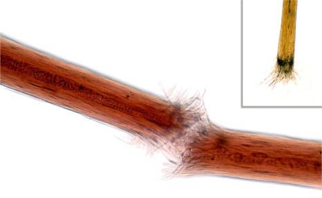 Fig. 22.1, Hair shaft sample. Trichorrhexis nodosa. The sample must not be taken using pull traction but rather by cutting it proximally. Otherwise, the sample will only show the distal end as shown in the upper right-hand corner.