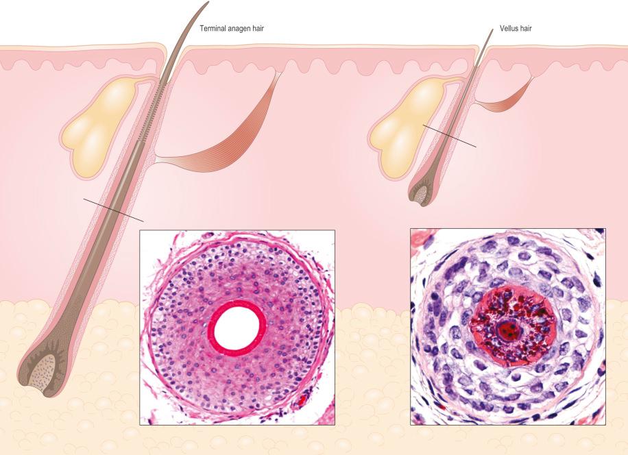 Fig. 22.12, Terminal anagen and vellus hair, vertical and horizontal sections: the terminal hair follicles reach the fat and are deeply embedded within it. The vellus hairs and miniaturized follicles are located within the dermis. Note the differences between the relative size of the hair shaft and the inner root sheath in terminal and vellus hairs.