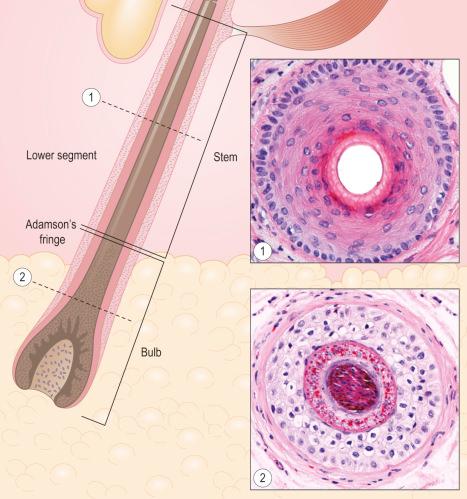 Fig. 22.19, Terminal anagen hair, vertical and horizontal sections of the lower segment: note the shaft and the hair bulb deep to Adamson fringe. The horizontal sections show (1) the stem and (2) the upper part of the bulb. Note the loss of nuclei in the hair shaft and the inner root sheath.