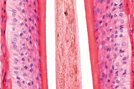 Fig. 22.21, Terminal anagen hair, lower segment: the pink inner root sheath (anucleated) clearly contrasts with the outer root sheath (nucleated) in this vertical section. The cuticle has a serrated border orientated in the opposite direction to that of the inner root sheath. The cells of the outer root sheath have clear cytoplasm due to prominent intracytoplasmic glycogen at this level.