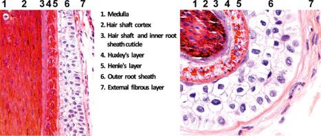 Fig. 22.24, Terminal anagen hair follicles: horizontal and vertical sections immediately below the Adamson fringe. Note the different layers of the hair follicle. (1) Medulla, (2) cortex, (3) cuticle of the hair and cuticle of the inner root sheath, (4) Huxley layer, (5) Henle layer, (6) outer root sheath, and (7) vitreous and external fibrous layer (perifollicular connective tissue sheath).