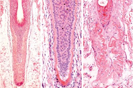 Fig. 22.28, Terminal hair follicles in catagen and telogen, vertical sections: the involution of the hair follicle leaves behind a thickened basement membrane.