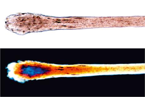 Fig. 22.3, Polarized light microscopy. Normal architecture of the hair shaft and the bulb in telogen is observed with normal light ( above ) and polarized light ( below ).