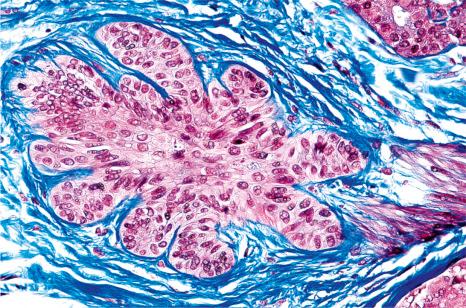 Fig. 22.31, Terminal hair follicle in telogen, secondary germ: horizontal section stained with Masson trichrome.