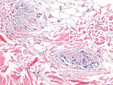 Fig. 22.33, Follicular stella, horizontal section: note the small blood vessels mixed with concentrically arranged connective tissue.