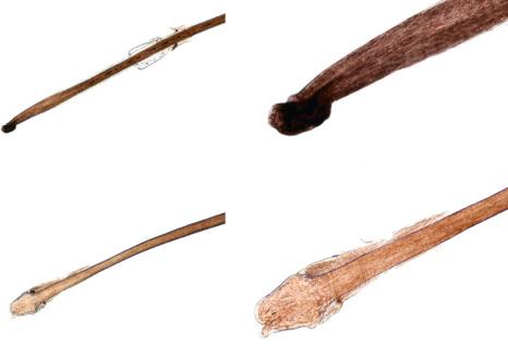 Fig. 22.4, Anagen and telogen hair shafts obtained by traction. Note differences in shape and pigmentation between the anagen hair ( top ) and the telogen club hair ( bottom ).