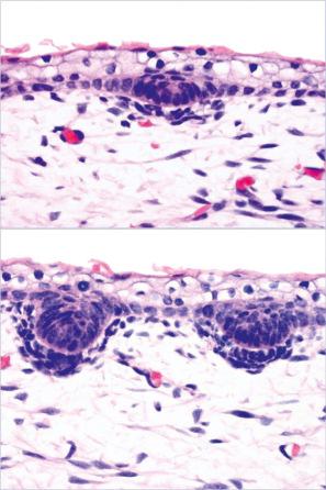 Fig. 22.10, Fetal hair follicle, upper and lower panel: epidermal precursor and primary hair germ with underlying connective tissue cells (dermal condensate).