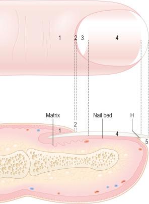 Diseases of the nails - Clinical Tree