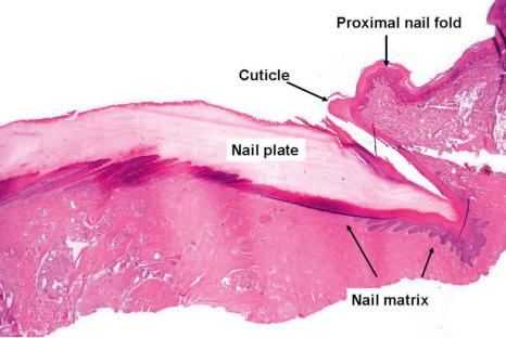 Fig. 23.4, Normal nail: scanning view of the proximal part of the nail apparatus.