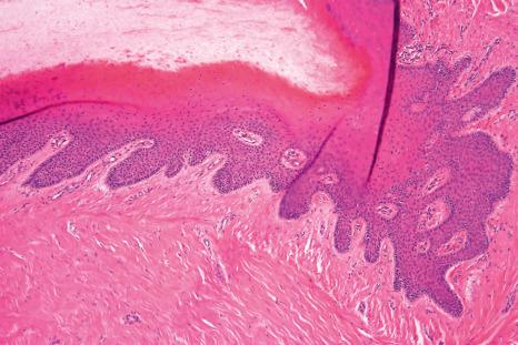 Fig. 23.7, Normal nail: low-power view showing the proximal nail matrix.