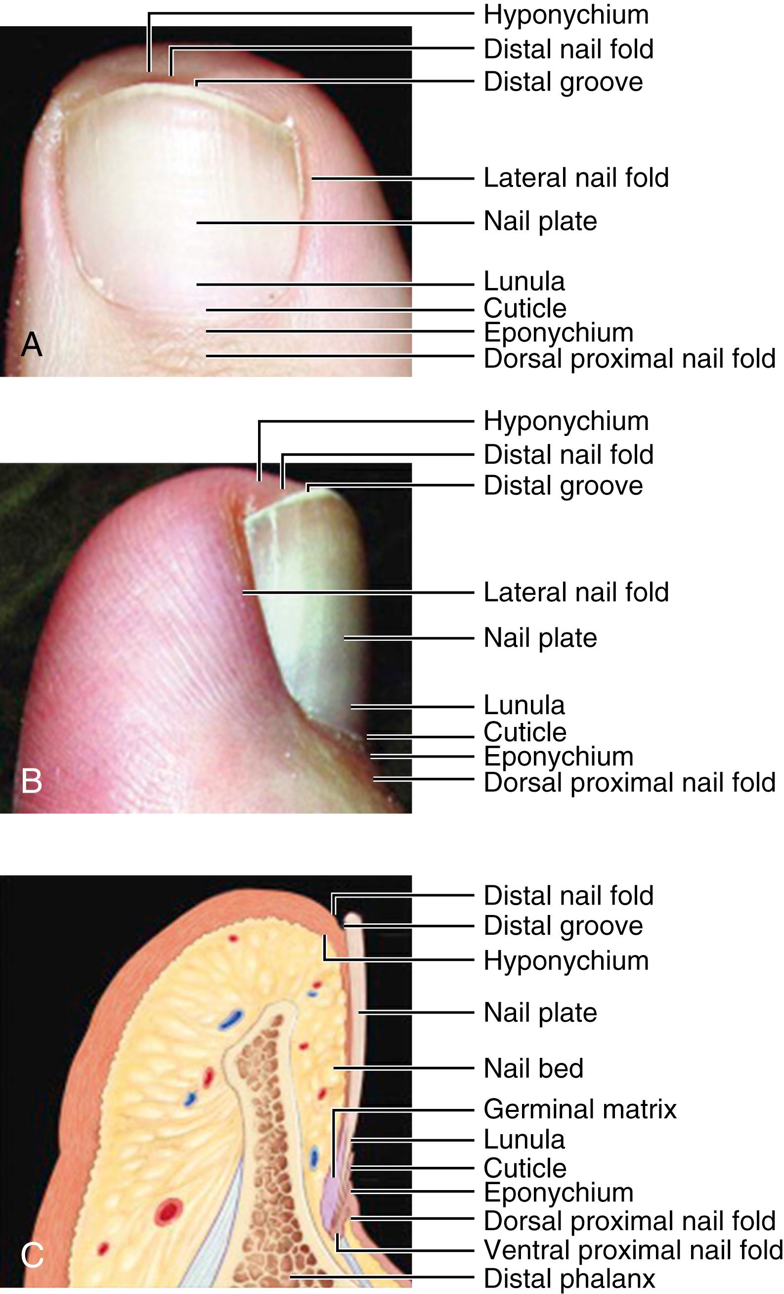 FIGURE 88.1, A and B , Anatomy of normal nail. C , Cross-section of normal nail.