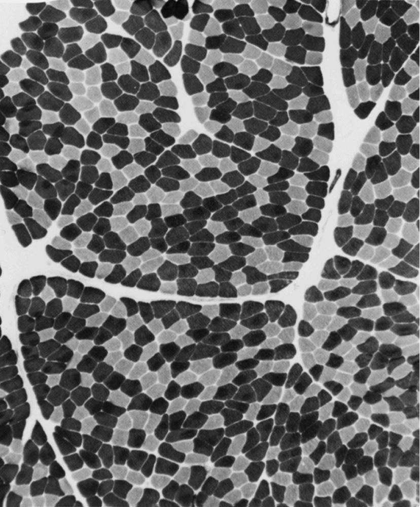 Fig. 109.2, Normal Muscle Biopsy.