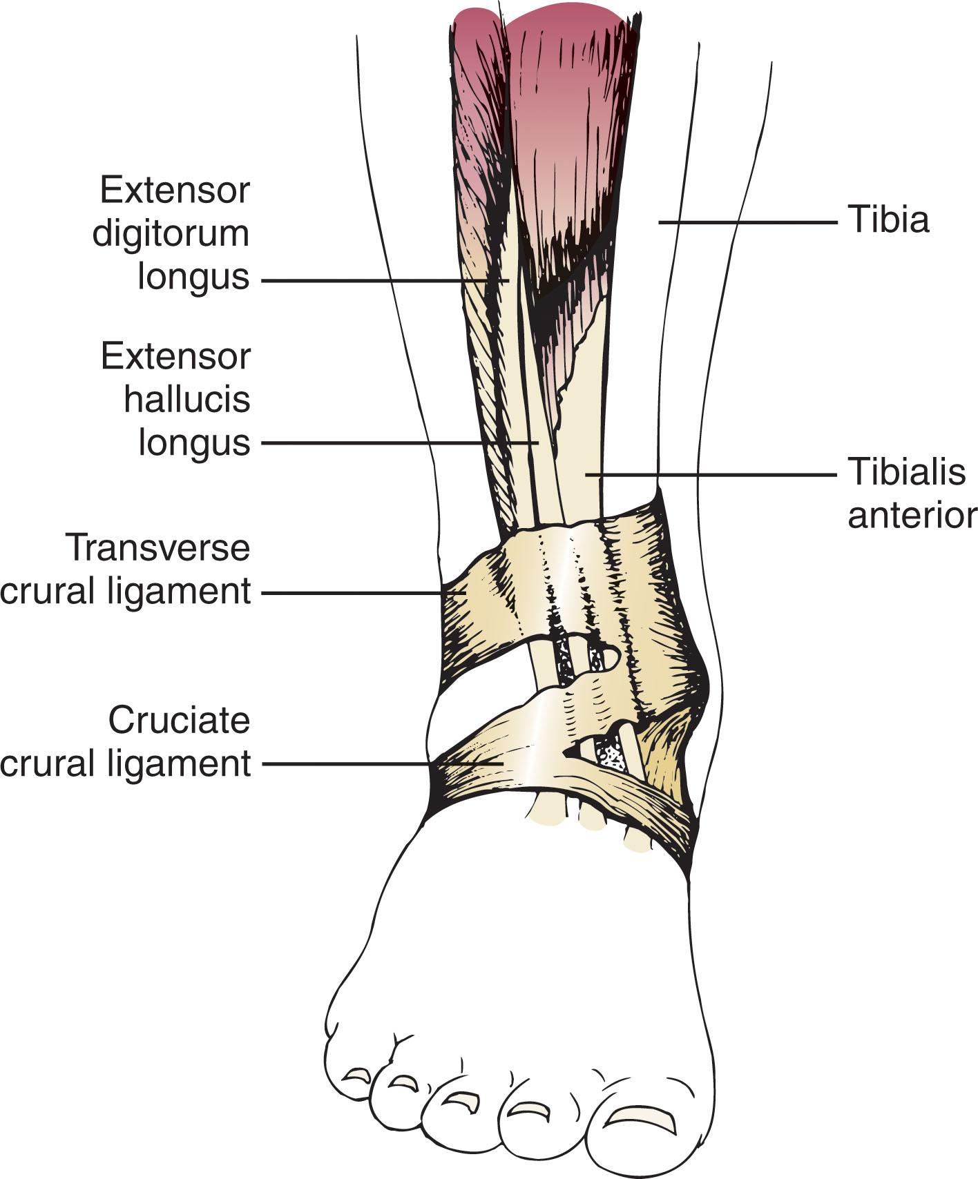 Fig. 28-1, The anterior tibial tendon courses beneath the transverse crural ligament and cruciate crural ligament before inserting on the plantar medial aspect of the first cuneiform and plantar base of the first metatarsal.