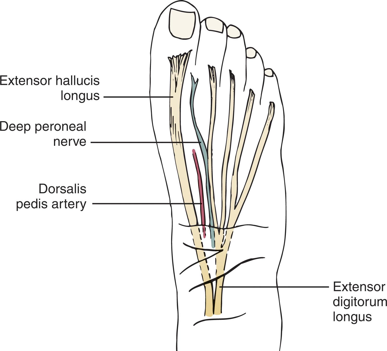 Fig. 28-31, The extensor digitorum longus tendon divides into two separate tendons beneath the extensor retinaculum and then further divides into separate tendons to the four lesser toes.