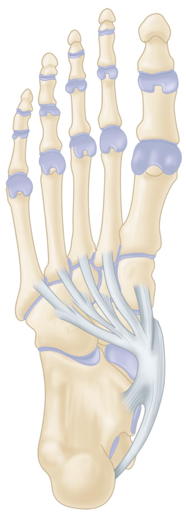 FIGURE 83.3, Posterior tibial tendon inserts into medial tuberosity of navicular (one main slip) and continues through second slip into plantar surface of foot, where it arborizes and inserts into all three cuneiforms, cuboid, and bases of second, third, fourth, and fifth metatarsals.