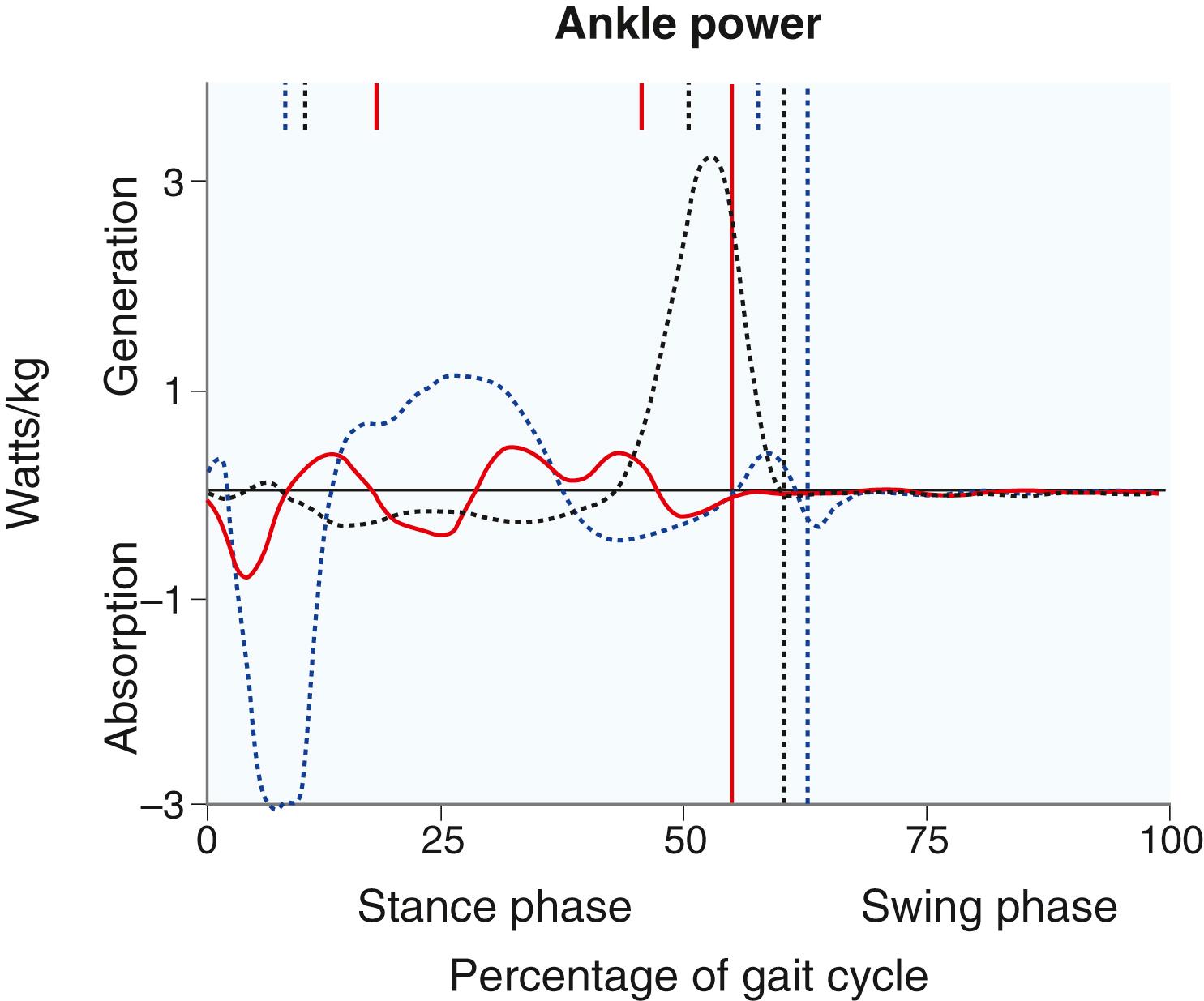 Fig. 31.12, As the gastrocsoleus contracts at heel rise, the ankle generates a burst of power (black dotted curve) . In patients with either equinus or calcaneus gait secondary to cerebral palsy, power generation is decreased. ( Red curve is the right side; blue dotted curve is the left side). Vertical lines designate divisions between the stance and swing phases for each leg.