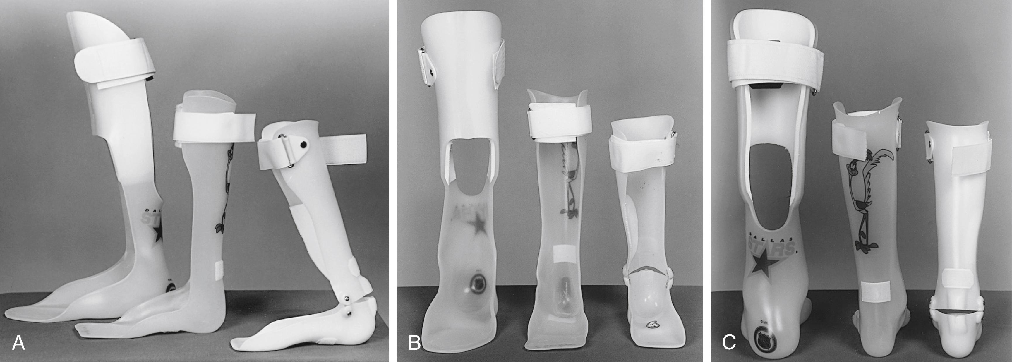 Fig. 31.13, (A–C) Different views of common ankle-foot orthoses (AFOs) used in patients with cerebral palsy. The orthosis on the left is a ground reaction AFO that extends across the anterior aspect of the tibia to prevent flexion of the knee in stance. The center orthosis is a conventional solid ankle AFO. The orthosis on the right is a hinged AFO that allows dorsiflexion of the ankle but prevents equinus.