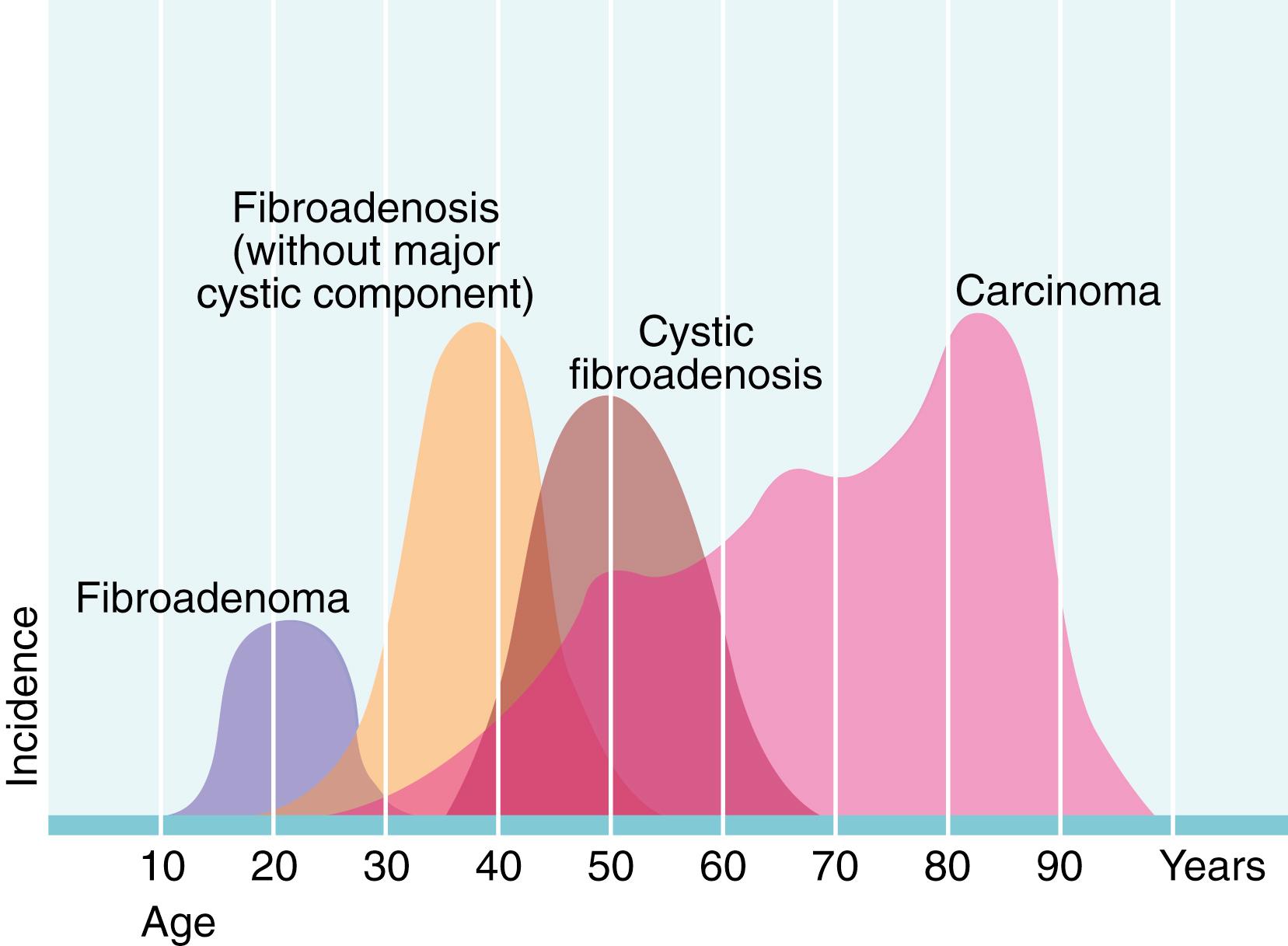 Fig. 45.2, Age Incidence of Common Breast Disorders.