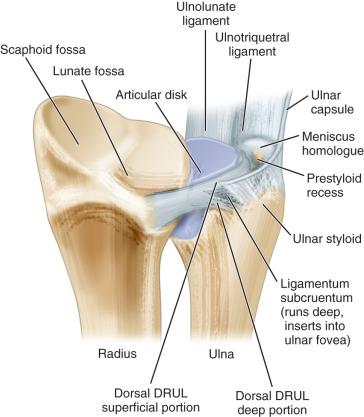 Fig. 72.2, Anatomy of the foveal attachment of the triangular fibrocartilage complex and the ligamentum subcruentum.