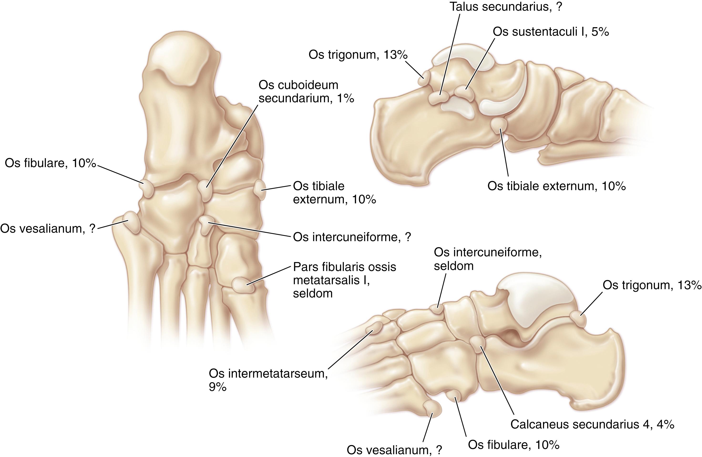 Fig. 19.7, Accessory bones in the foot and the percentage of individuals in which they are found.