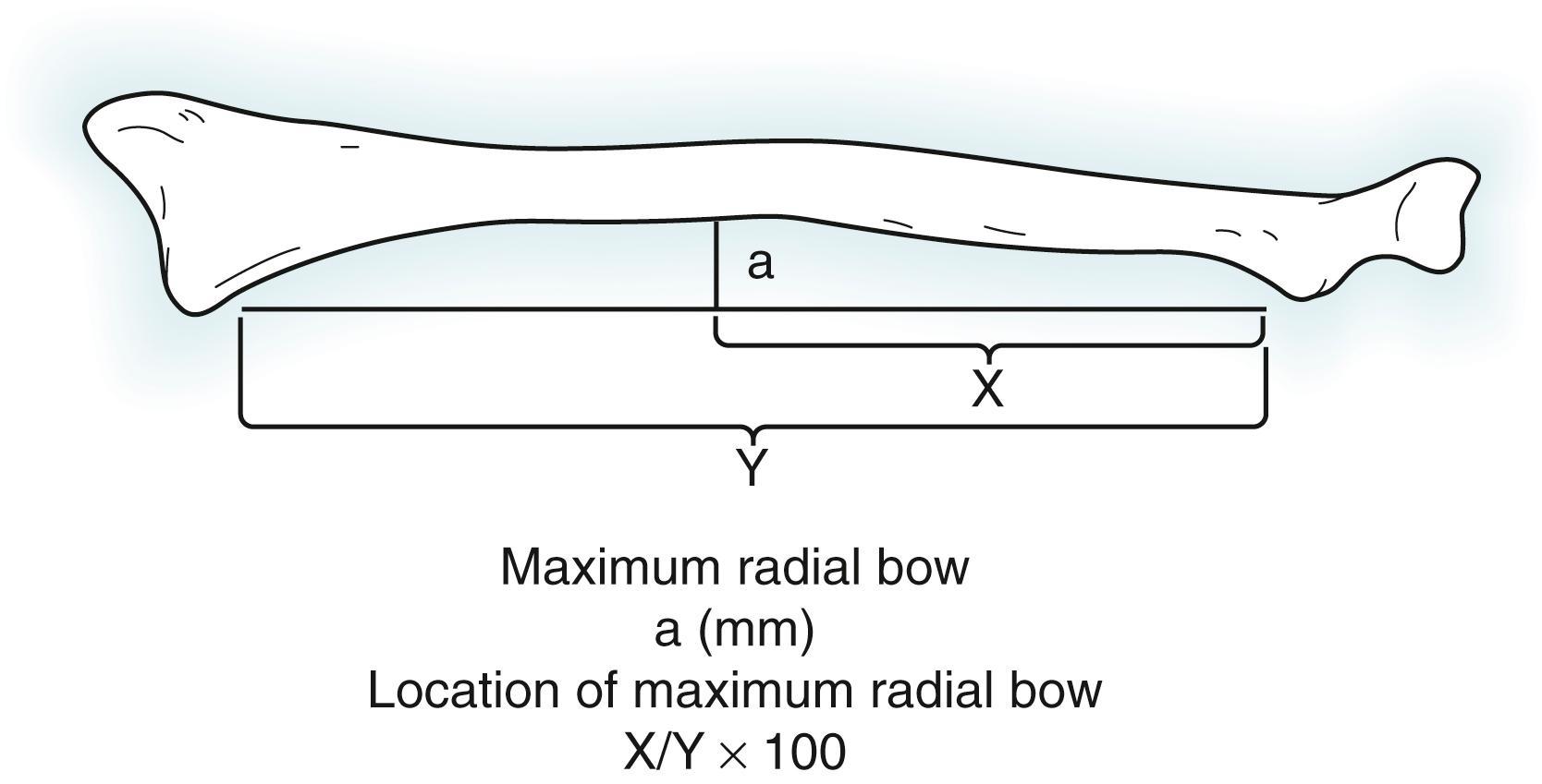 Fig. 21.7, Measuring radial bow.