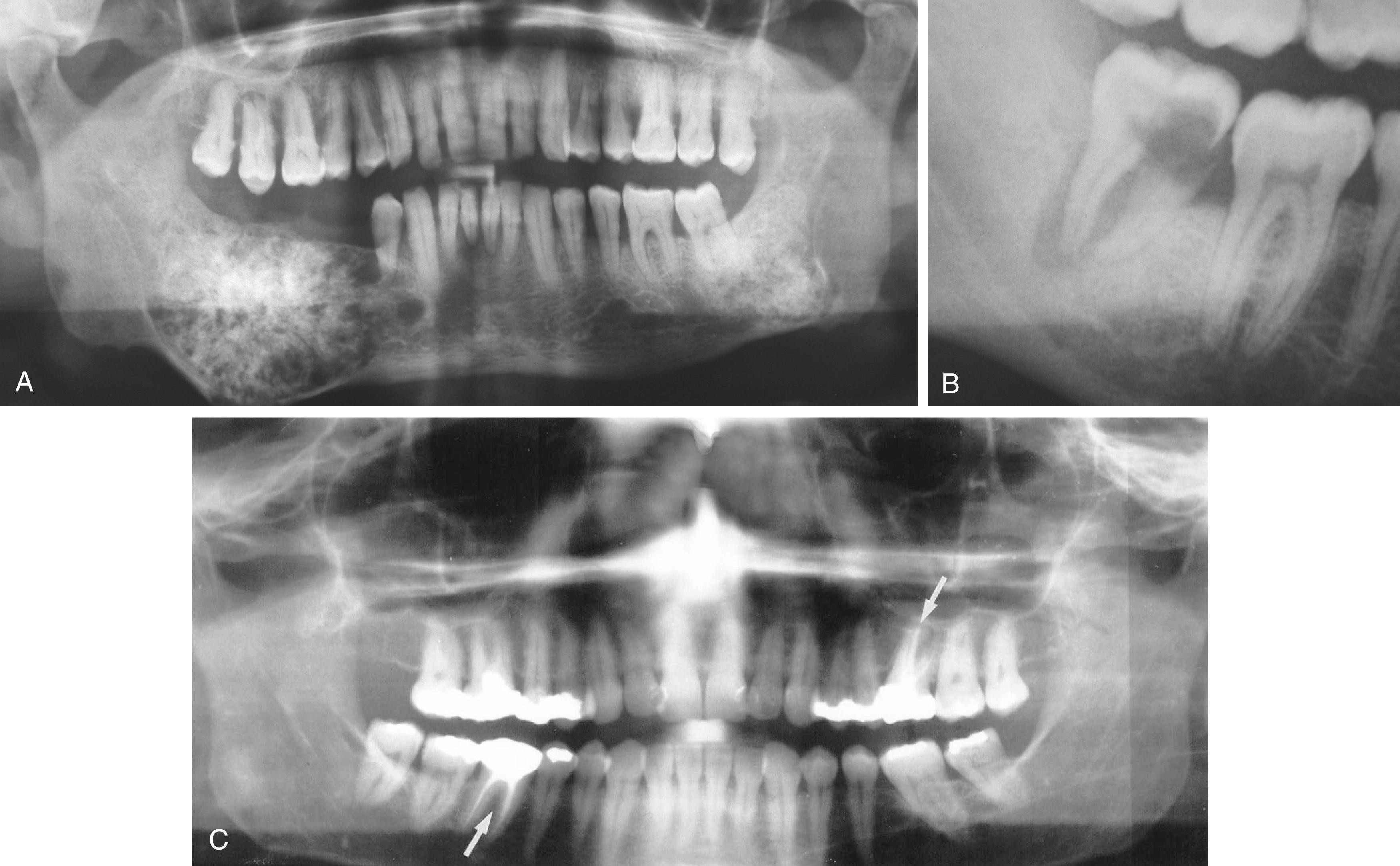 Fig. 48.2, Various jaw and dental findings on X-ray.
