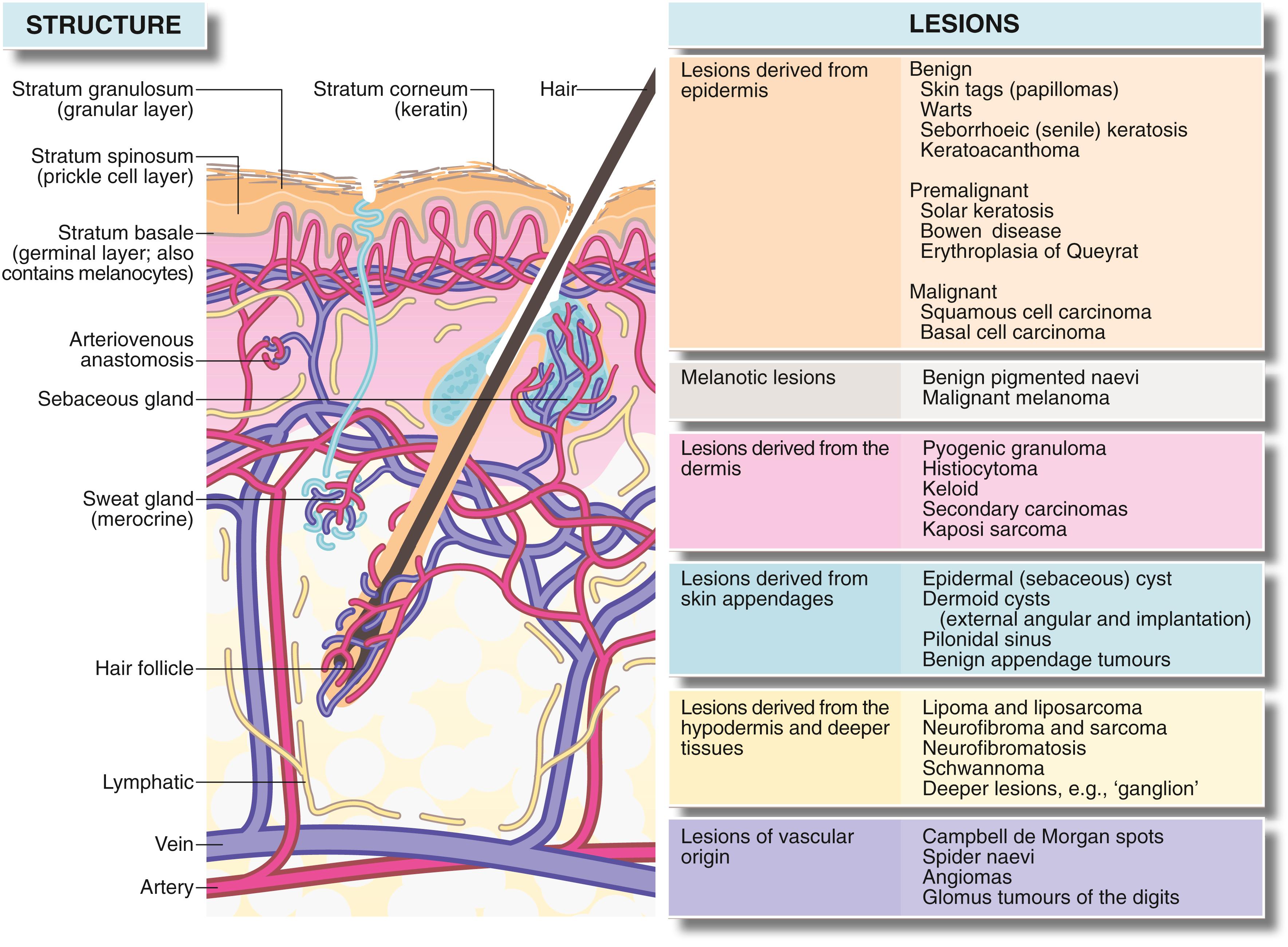 Fig. 46.1, Structure of the Skin and Lesions of Surgical Importance.