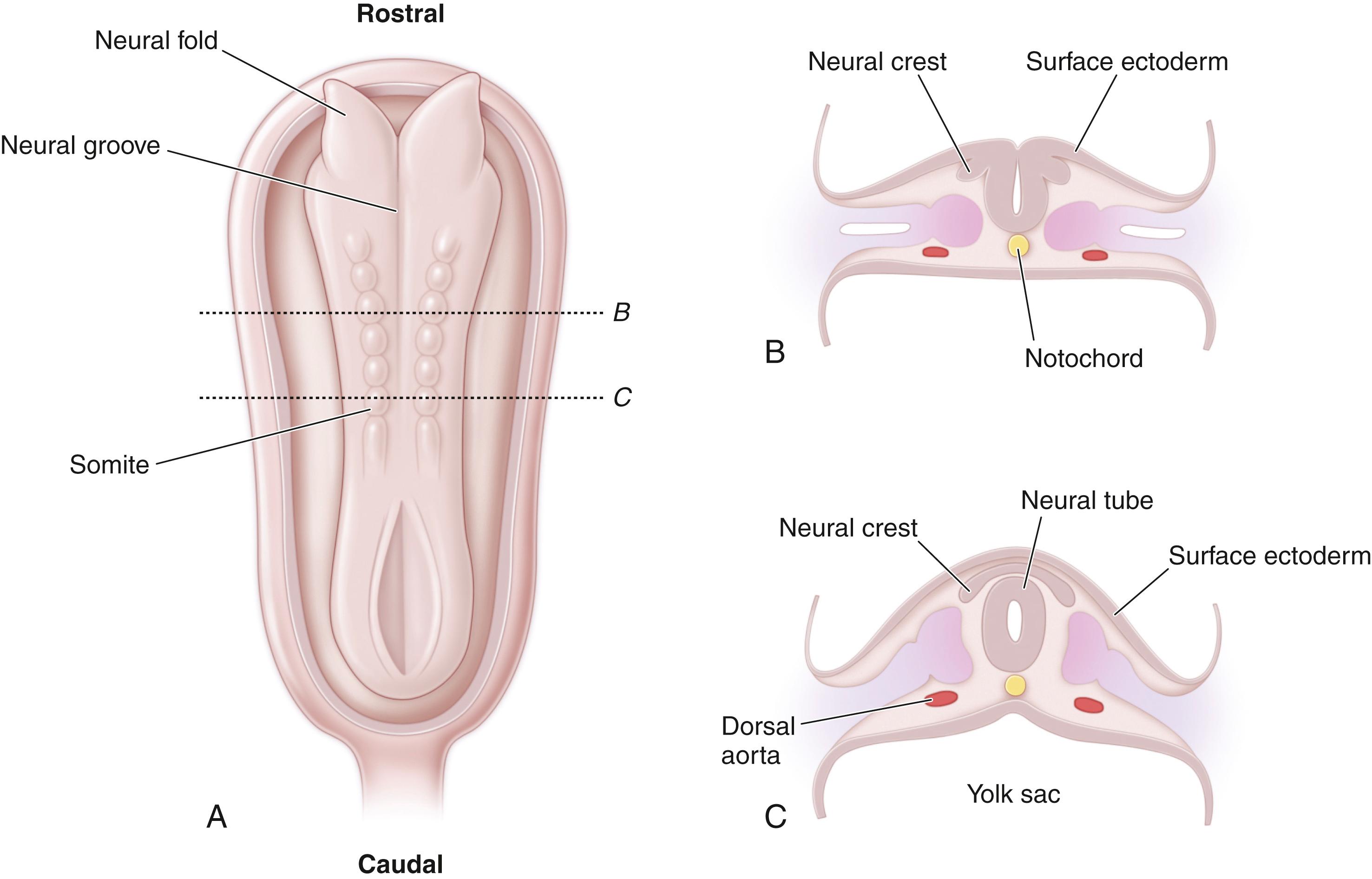 Fig. 32.1, Embryologic development of the spinal cord, demonstrating the formation of the neural crest with infolding of the neural plate into the neural tube. (A) Embryonic appearance at approximately 22 days. The neural tubes have fused opposite the somites but are widely spread out at both ends of the embryo. Closure of the neural tube occurs initially in the region corresponding to the future junction of the brain and spinal cord. (B) Cross section at level B (of part A) demonstrating formation of the neural tube and its detachment from the surface ectoderm. (C) Cross section at level C (of part A). Note that some neuroectodermal cells are not included in the neural tube but remain between it and the surface ectoderm as the neural crest. These cells first appear as paired columns but soon break into a series of segmental masses.