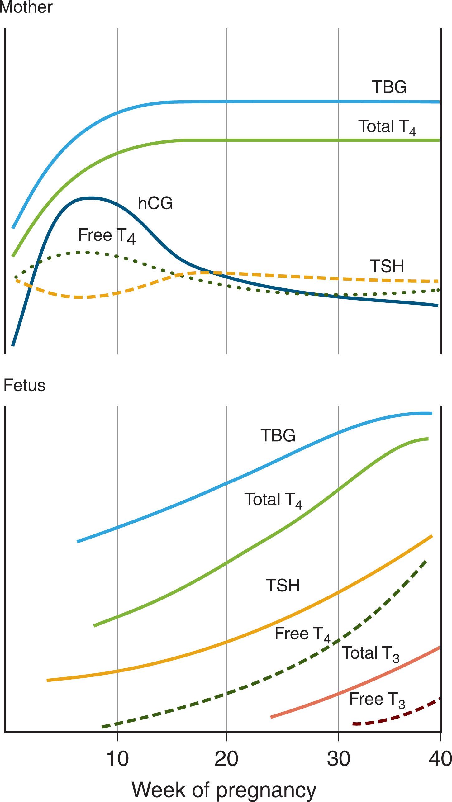 Fig. 86.4, Relative changes in maternal and fetal thyroid function during pregnancy. The effects of pregnancy on the mother include a marked and early increase in hepatic production of thyroxine (T 4 ) -binding globulin (TBG) and placental production of human chorionic gonadotropin (hCG) . The increase in serum TBG level, in turn, increases serum T 4 concentrations; hCG has thyroid-stimulating hormone (TSH) -like activity and stimulates T 4 secretion. The transient hCG induces increase in serum T 4 and inhibits maternal secretion of TSH.