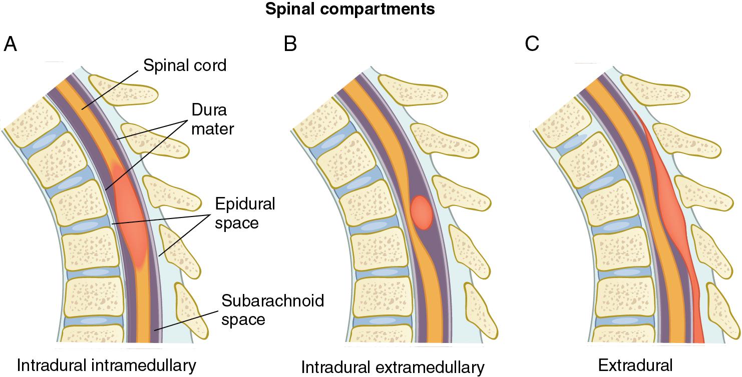 Fig. 61.2, Spinal compartments.