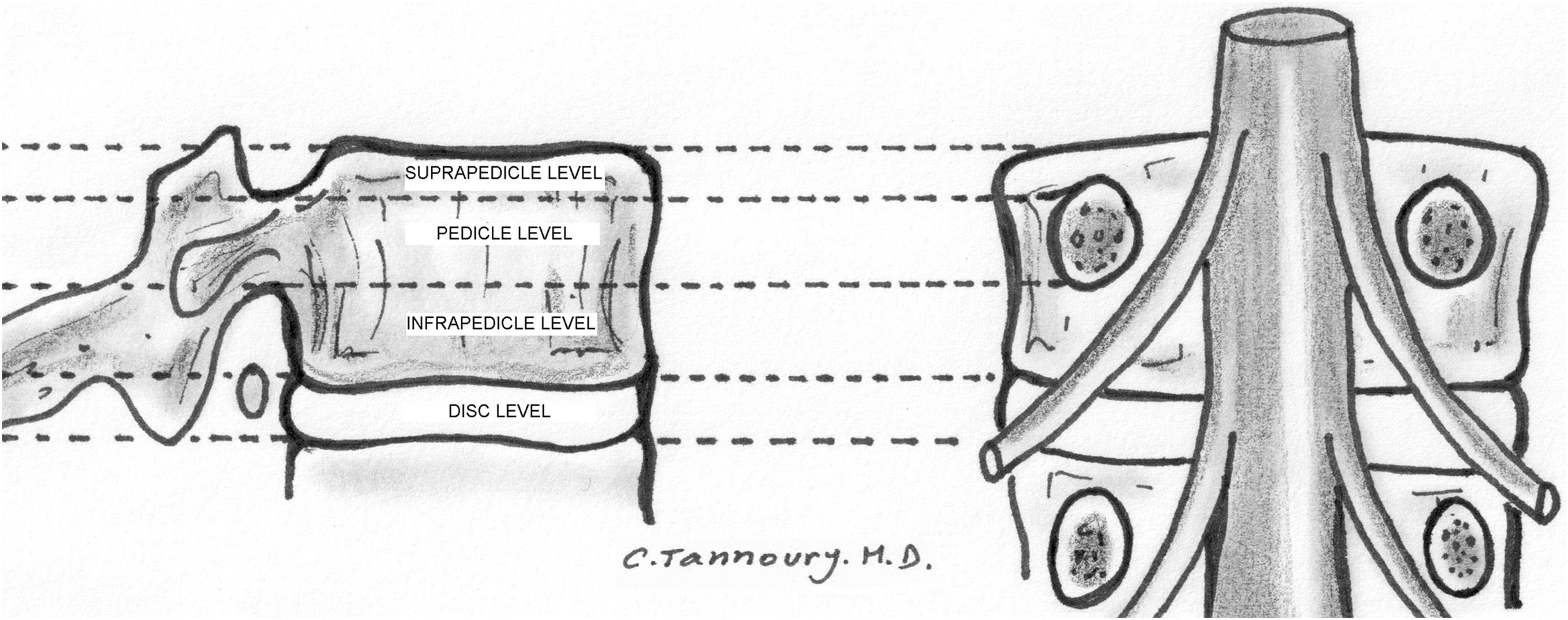 Figure 8.3, Schematic illustration of anatomic levels and zones.
