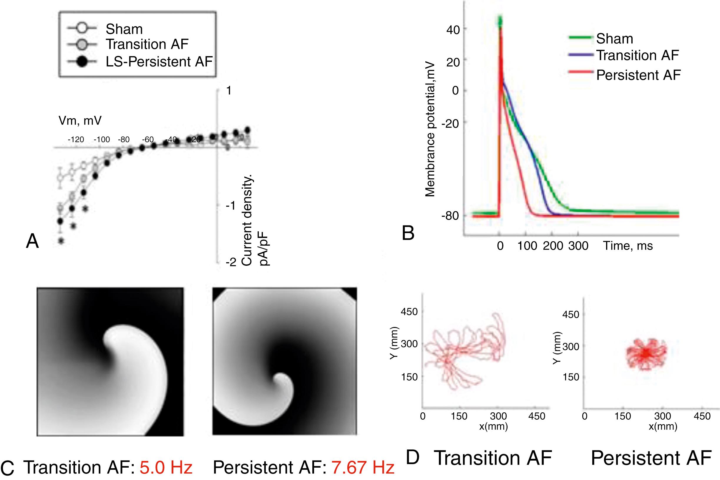 Fig. 52.3, Inward rectifier potassium current (I K1 ) increases in the progression of atrial fibrillation (AF) acting to accelerate and stabilize rotors in persistent AF.