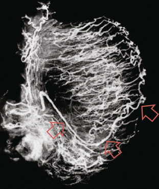 FIGURE 13-5, Microangiogram of the testicle. A prominent capsular branch (open arrows) courses from the testicular artery under the capsular surface. Centripetal arterial branches emanate from it and pass into the lobules of the testicle.