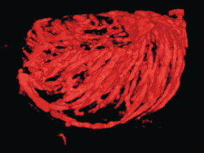 FIGURE 13-6, 3-D rendered power Doppler acquisition of a testicle. With very sensitive Doppler settings, the network of centripetal arteries is seen fanning across this normal testicle.