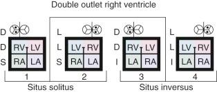 Figure 53-1, Model of the four basic hearts as they occur in double outlet right ventricle, with usual great artery positions (aorta lateral to pulmonary trunk). Models 2 and 3 show atrioventricular discordant connection. The Van Praagh symbolic convention is used (see “Symbolic Convention of Van Praagh” under Terminology and Classification of Heart Disease in Chapter 1 ). Key: LA, Left atrium; LV, left ventricle; RA, right atrium; RV, right ventricle.