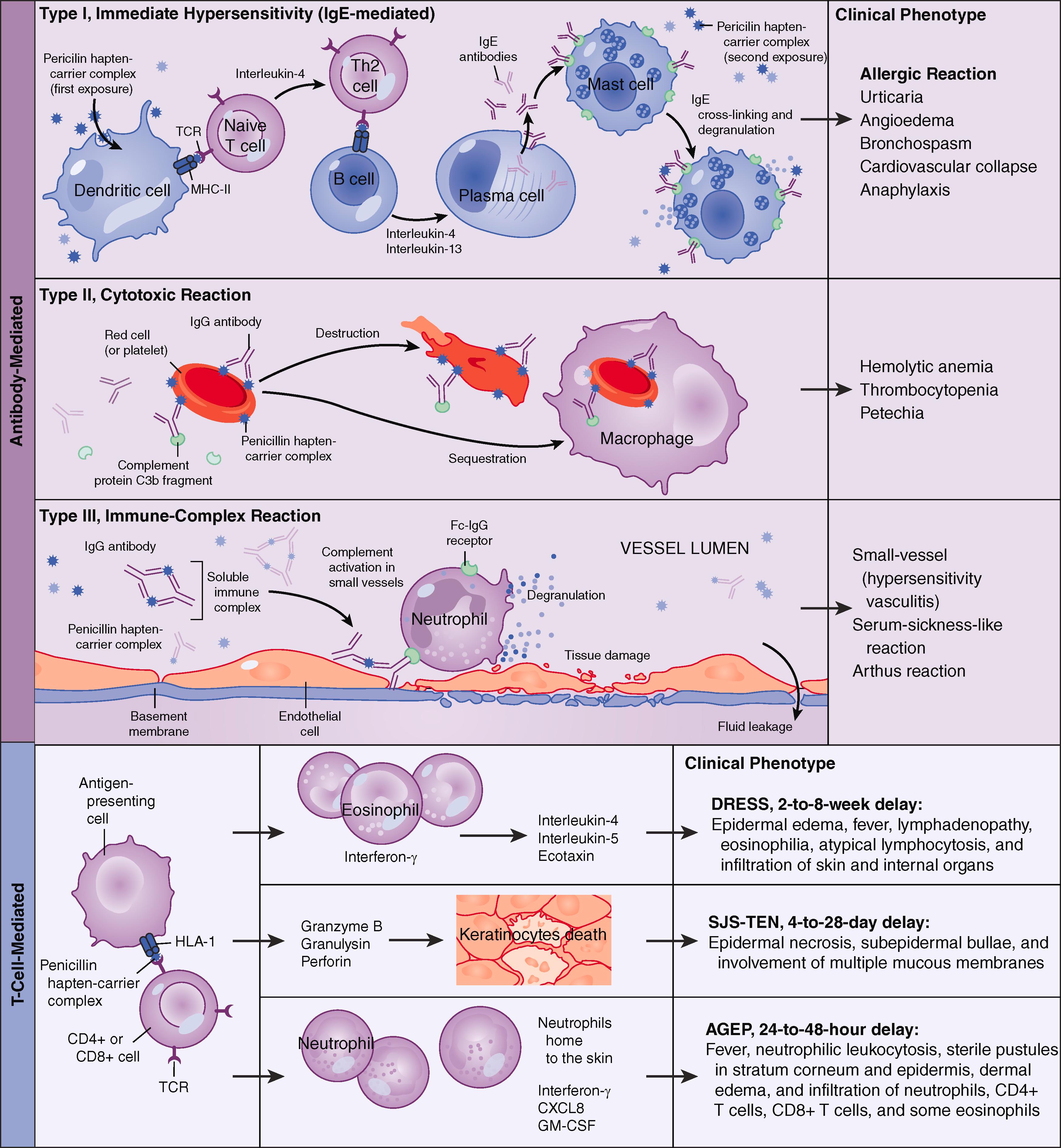 E-FIGURE 234-2, Clinical manifestations and mechanisms of adverse reactions to penicillins.